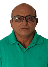Foto de QUEIMADURA