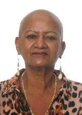 Foto de SU CARECA